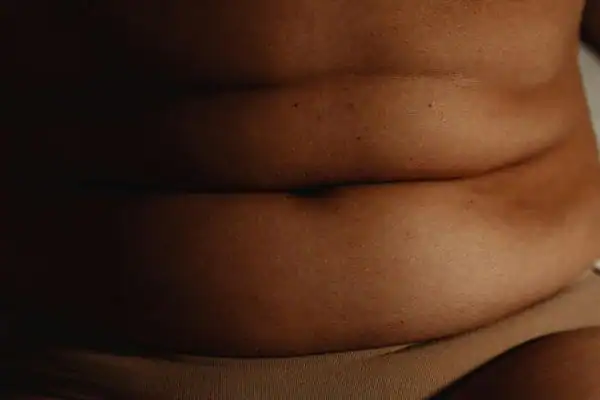 The Hidden Connection: How Stress Shapes Your Fitness and Body Composition 3 image of what stress can do on the stomach area and how Lipo 360 Hamilton can help to change your body shape.